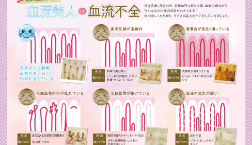 血流チェック