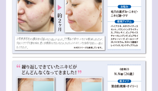 バイアクネ症例結果