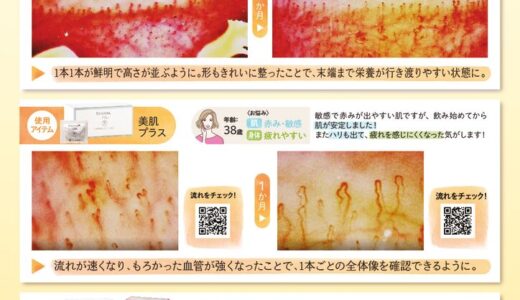 血流が肌と身体を変えるカギ！