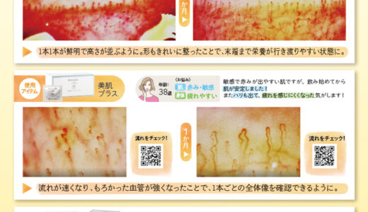 血流が肌と身体を変えるカギ！