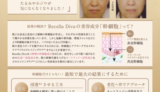 Recella Divaって何がすごいの？