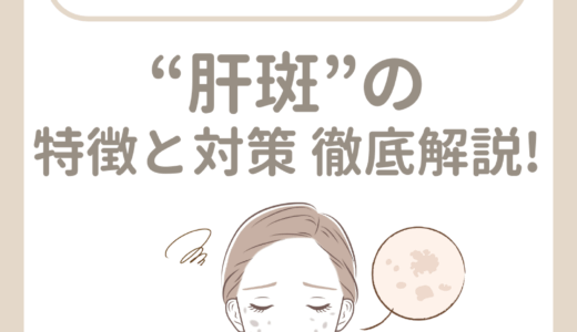 “肝斑”の特徴と対策 徹底解説!