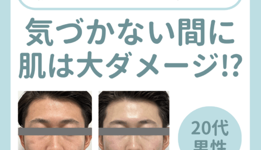 気づかない間に肌は大ダメージ！？