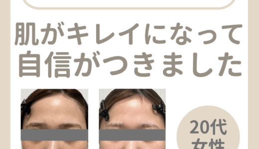 肌がキレイになって自信がつきました