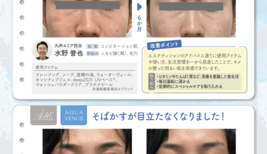 ドクターリセラ新入社員の肌記録
