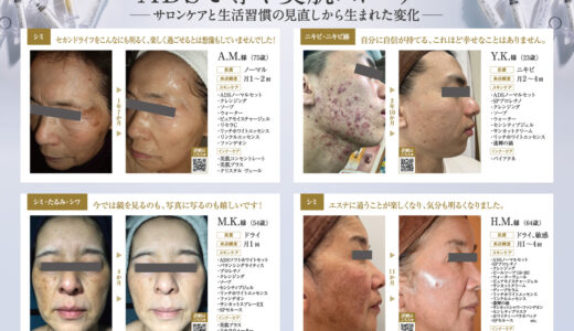 ADSで導く美肌ストーリー