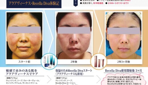 アクアヴィーナス・Recella Diva体験記