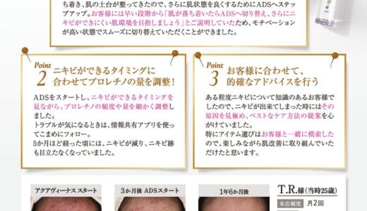 ADS感動ストーリー