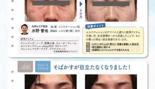 ドクターリセラ新入社員の肌記録