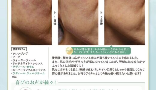 ラディール　症例POP（ホームケアに新しい選択）