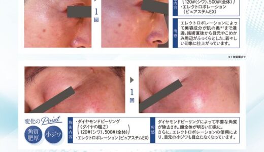 Re・vive・skinで叶える美肌