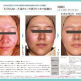 2511_diva-shorei-gpのサムネイル