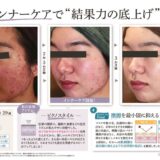 2601_innercare-shoreiのサムネイル