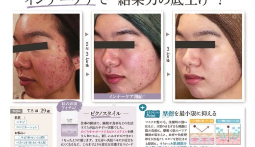 インナーケアで“結果力の底上げ”！